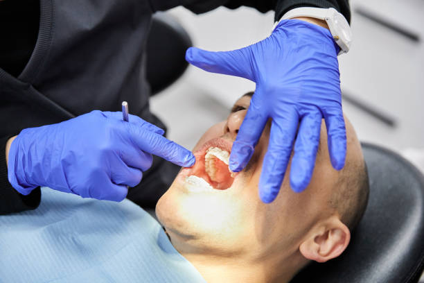 Best Dentist for Tooth Abscess  in Tarpon Springs, FL